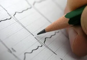 Усложнения след лечение CABG на усложнения след сърдечна операция за байпас (CABG) в програмата