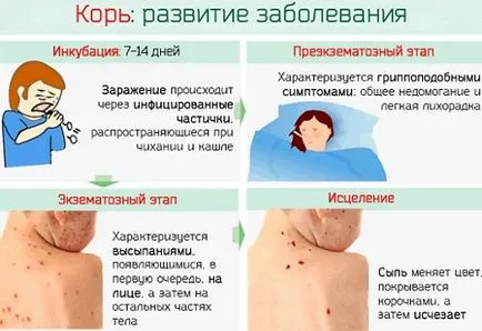 Защо детето може да има суха кашлица и хрема и как да се отнасяме