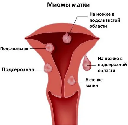 От това, което може да бъде кървава разряд