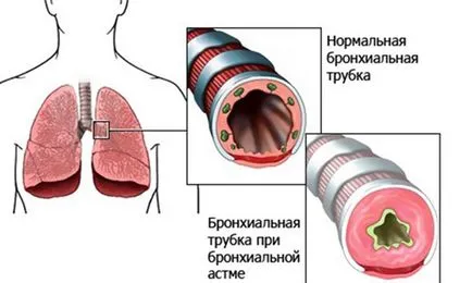 Препарати за втечняване на храчки по-специално за лечение на кашлица