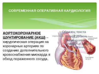 Представяне - превенция на сърдечно-съдови заболявания - свободно изтегляне