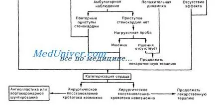 Насоки Ангина Лечение