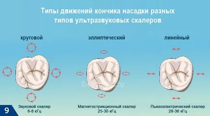Професионално почистване на зъбите - както трябва да бъде, цената