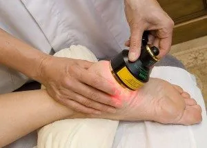 Heel разклонения fiziolechenie (лечение на петата разклонения) Calcaneal шпора физиотерапия