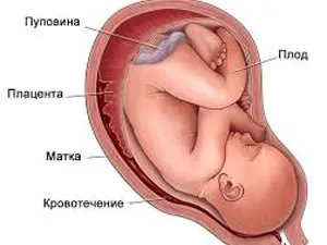 Местоположение на плацентата на предната стена на протичането на бременността и потенциалните рискове (стената) Местоположение на плацентата на предната стена на протичането на бременността и потенциалните рискове