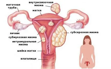 Pink заустване на причините за жени, в размер на патология, кога да се свържете с лекар (хормоналната) Pink заустване на причините за жени, в размер на патология, когато е да отидеш на лекар