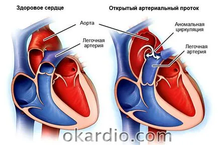Симптомите на сърдечна недостатъчност, лечение, какво е това