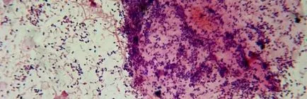 ДНК Gardnerella това Vaginalis