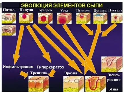 Обрив на лактите при възрастни, сърбеж, коленете и лактите