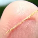 Суха кожа на ръцете си - причини, лечение и профилактика (лечение) Суха кожа на ръцете - причини, лечение и профилактика