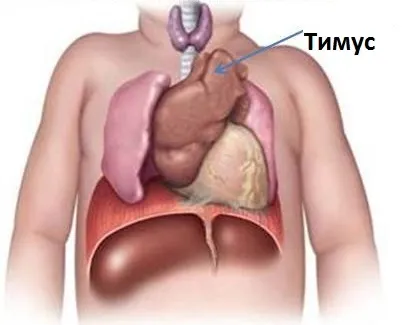 Thymomegalia децата какво е, и с това е необходимо да се бори
