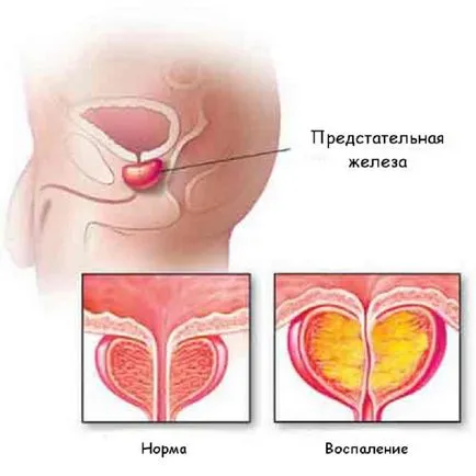 Какво се случва с човека на сутринта не всеки знае, но толкова полезни! 1