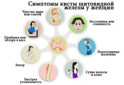 Възлите на щитовидната жлеза в женските симптоми и лечение, което е, какви са последиците