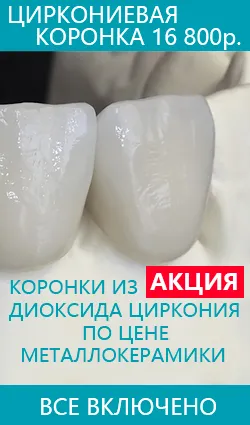Опции протеза горната предни, долни зъби, Цена, мнения, отзиви, снимки