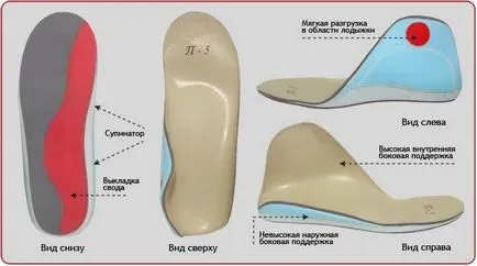 Valgus крак деформация при деца снимка патологии (деца) Valgus крак деформация при деца снимка патология