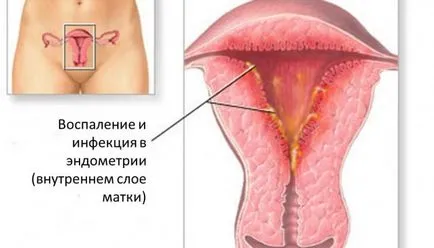 Разпределение междуменструално кървене между периодите, ацикличен, червени кръвни