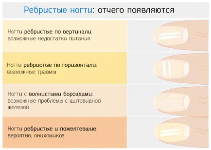 От това, което оребрени ноктите