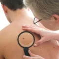 Висящи мол - Picture, Причини, симптоми, лечение и усложнения