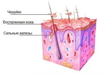 Възстановяване на косата у дома как да го направя бързо
