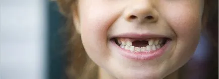 19 възможните ефекти на захапка