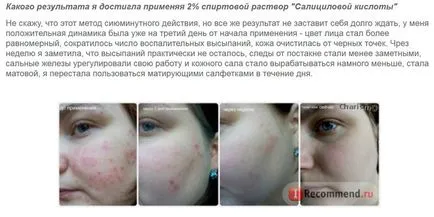 Разтвор на салицилова киселина, за който