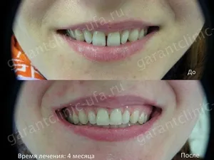 Скоби, клиника съвременната стоматология 