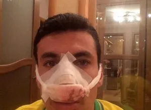 Какво да правите, ако си счупиш носа на първа помощ (стан) Какво да правите, ако си счупиш носа на първа помощ