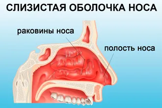 Какво е ринит (възпаление на носната лигавица) - ринит в етап възрастен