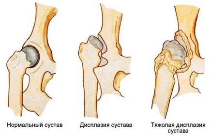 Какво е дисплазия при кучета, нейните симптоми и лечение