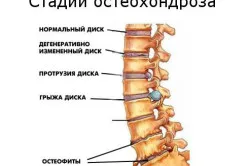 физиологична лордоза