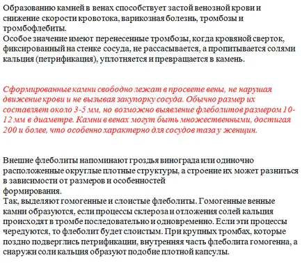 Phlebolith проблем flebolity в урология