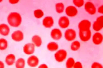 Промяна на размера на червени кръвни клетки microcytosis, макроцитоза, megalotsitoz, shizotsitoz, анизоцитоза