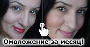 Защо се разшири ноктите Защо се разшири ноктите