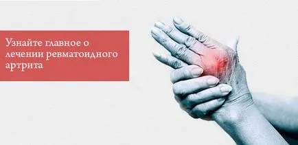 Лечение на ревматоиден артрит лекарства, физическа терапия, дом