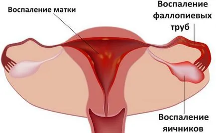 Месечен месец са причините, които правят