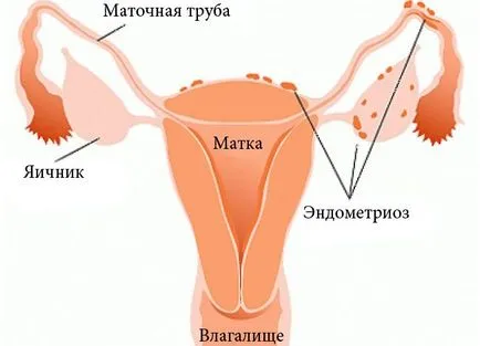 Месечен месец са причините, които правят