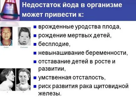 Разширената функция на щитовидната жлеза, че е