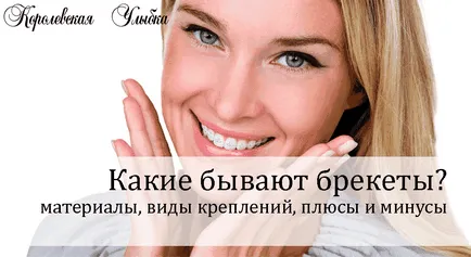 Ортодонтия в стоматологията - защо поставят скоби, защо оправя захапка, защо сложи скоби (натуропат) Ортодонтия в стоматологията - защо поставят скоби, защо оправя захапка, защо поставят скоби