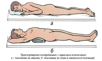 Spine лечение фрактура, симптоми, последици
