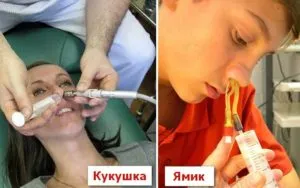Ако синузит не излиза гной какво да правя, как да се гнойта