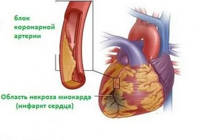 Белег на сърцето