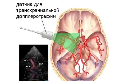 Какво е Доплер Какво е Доплер