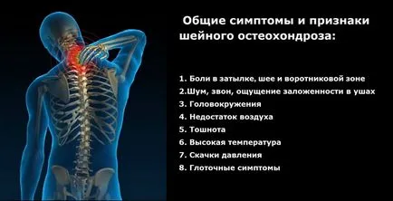 Симптомите на шийката на матката дегенеративни заболявания диск всички основни симптоми на заболяването
