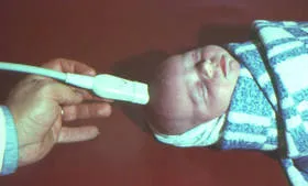 Узи дете, където да се направи като проучване, методи на ултразвук бебе (дете) Узи дете, където да се направи като проучване, методи на ултразвук бебе