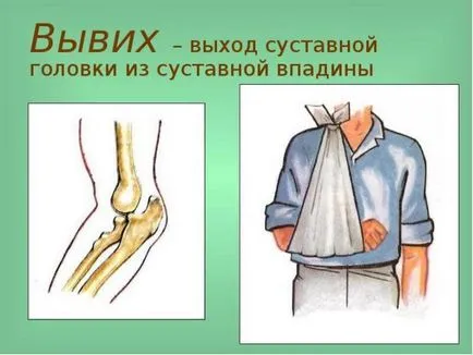 Разместване съвместен