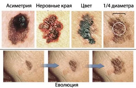 Къде са моловете идват от