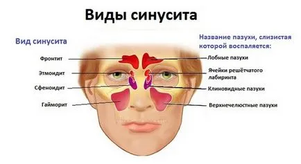 Green сополи при възрастни причини и лечение, както и за лечение, отколкото