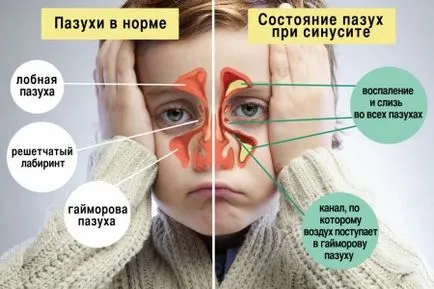 Антибиотик за лечение на синузит