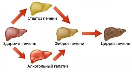 Как за лечение на черния дроб, след употреба на алкохол