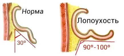 Какво става, ако големите уши